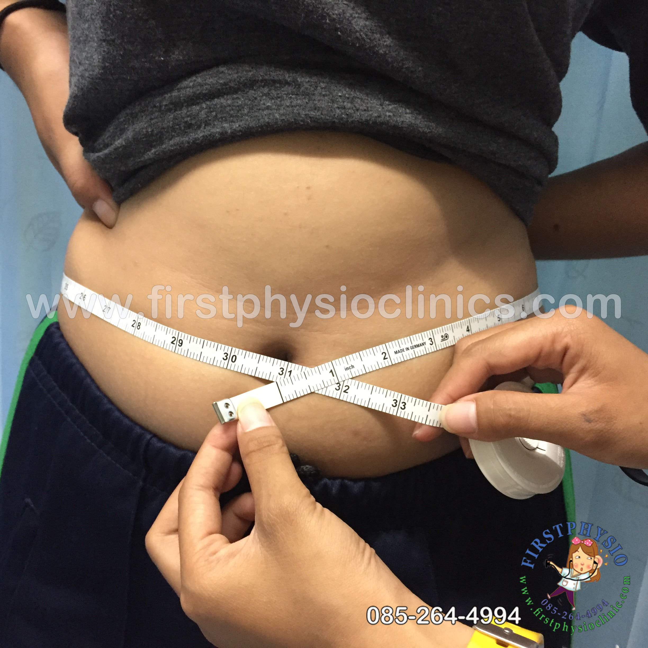 เข็มขัดช่วยเดิน (Safety Belt)