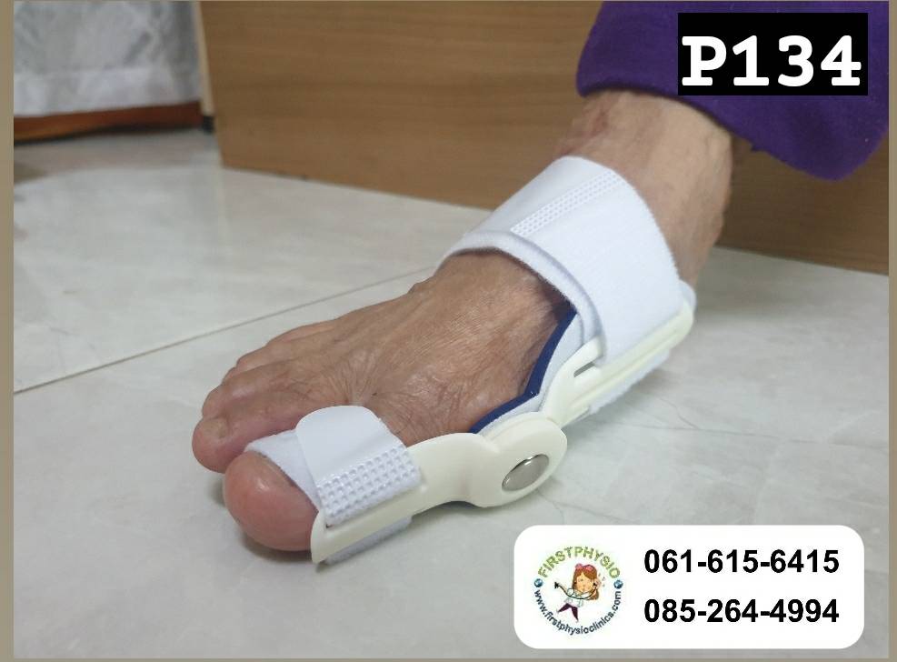 ที่ดามกันนิ้วหัวแม่เท้าเอียง/ที่ดามกันนิ้วโป้งเท้าเอียง/อุปกรณ์ดามนิ้วเท้าเก/อุปกรณ์แก้เท้าผิดรูป