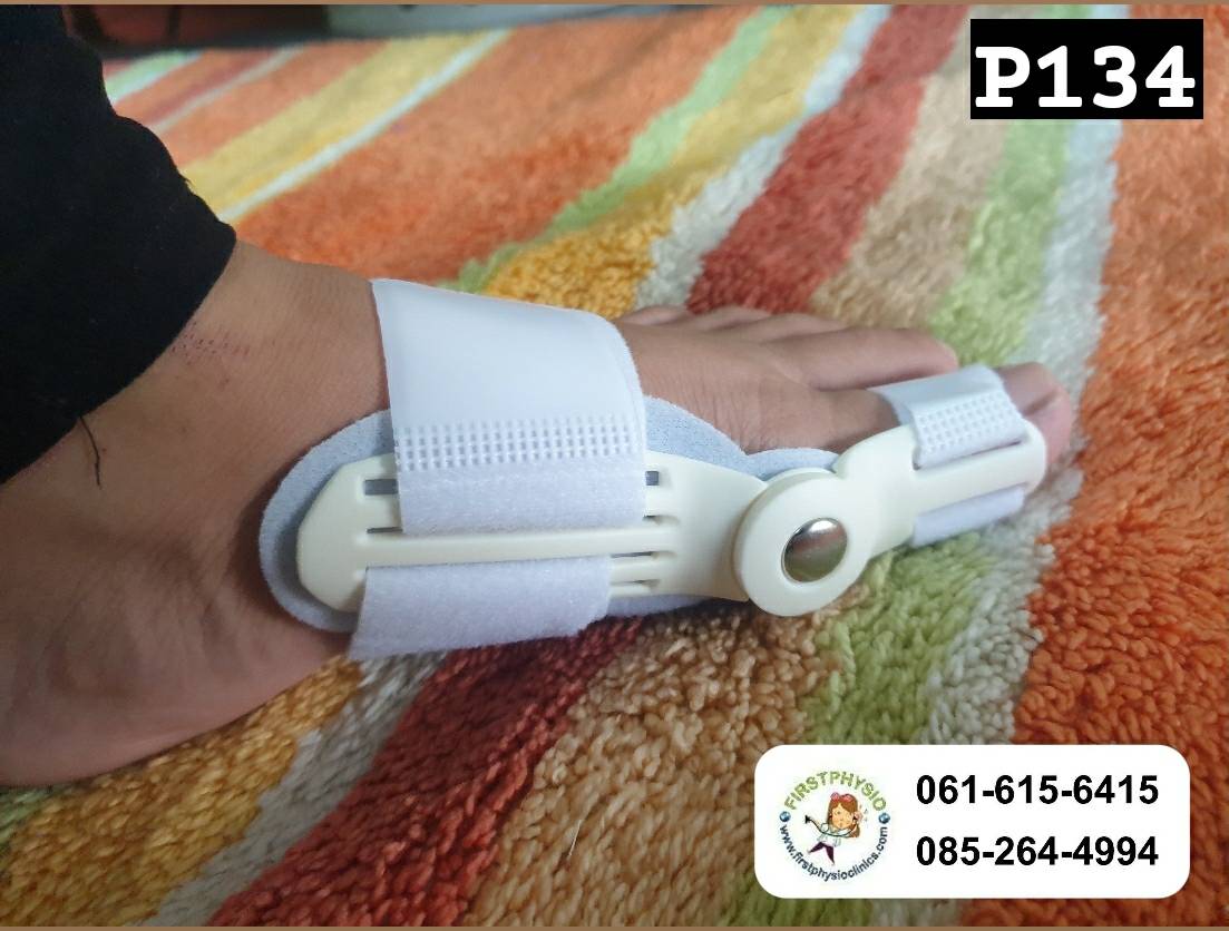 ที่ดามกันนิ้วหัวแม่เท้าเอียง/ที่ดามกันนิ้วโป้งเท้าเอียง/อุปกรณ์ดามนิ้วเท้าเก/อุปกรณ์แก้เท้าผิดรูป