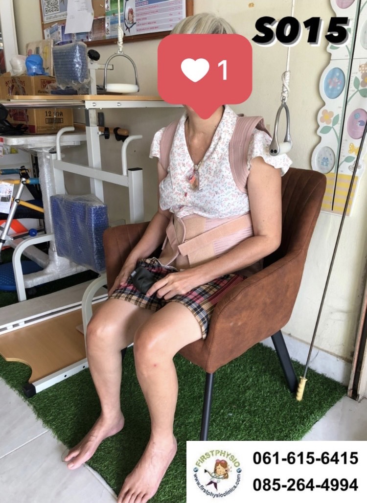 เสื้อพยุงหลังค่อมทางการแพทย์ พยุงหลังค่อม พยุงหลังคด เสื้อหลังค่อม สายรัดแก้ไขหลังค่อม เสื้อแก้หลังค่อม เข็มขัดพยุงหลัง thoracolumbar support