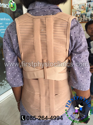 เสื้อพยุงหลังค่อมทางการแพทย์ พยุงหลังค่อม พยุงหลังคด เสื้อหลังค่อม สายรัดแก้ไขหลังค่อม เสื้อแก้หลังค่อม เข็มขัดพยุงหลัง thoracolumbar support