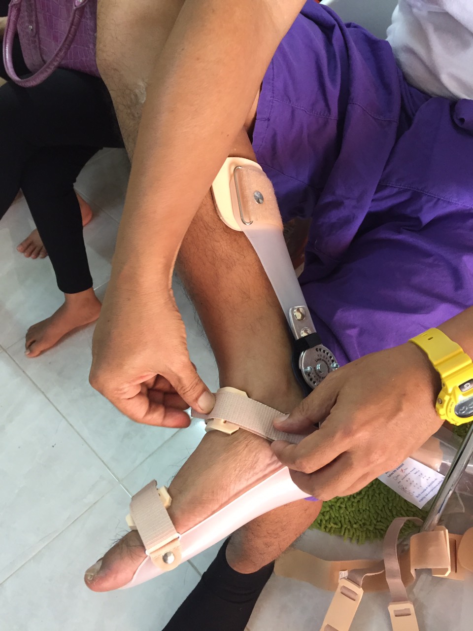 ดามกันปลายเท้าตกแบบปรับองศา (AFO Gait Assist) กันปลายเท้าตก เท้าแกว่ง ดามข้อเท้า ดามปลายเท้า ที่ประคองปลายเท้า