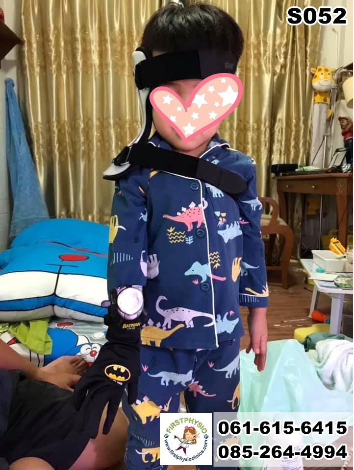 FIRSTPHYSIO/กันคอเอียงในเด็ก
