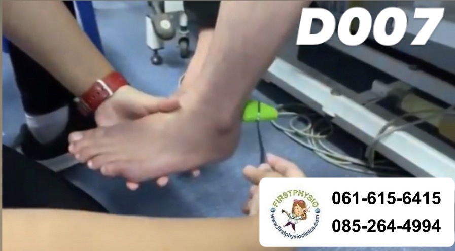 ไม้เคาะ Jerk/ ไม้เคาะเข่า/ค้อนเคาะเข่า/ค้อนยาง/KNEE JERK