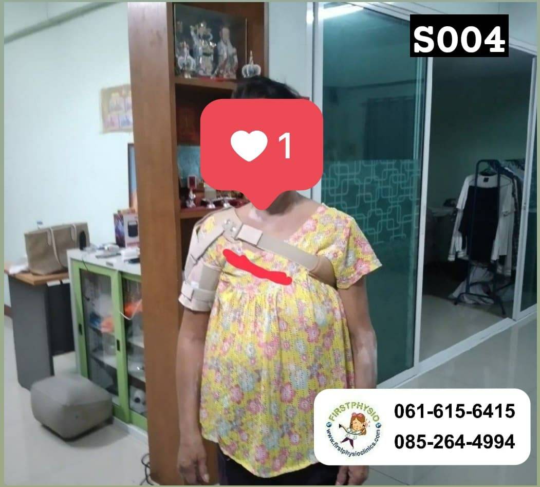 พยุงข้อไหล่หลวม พยุงไหล่ ที่พยุงไหล่ สายรัดพยุงไหล่ปรับได้ ประคองหัวไหล่ สายรัดไหล่ สายรัดพยุงไหล่ shoulder support Bobath Sling