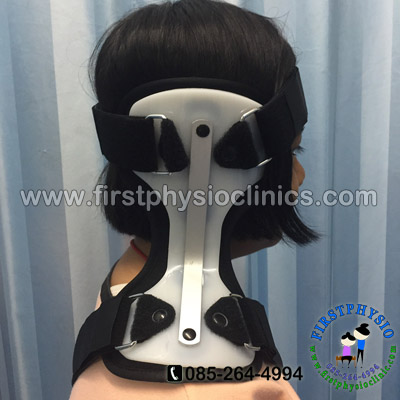 FIRSTPHYSIO/กันคอเอียงในเด็ก