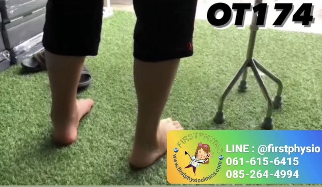 ช่วยเดินไม้เท้า 4 ขา ไม้เท้าอลูมิเนียมแบบ 4 ขา ไม้สี่ขา ไม้เท้าสี่ขา ไม้เท้าชนิด 4 ปุ่มไม้ 4-POINT CANE Walking stick 4 legs