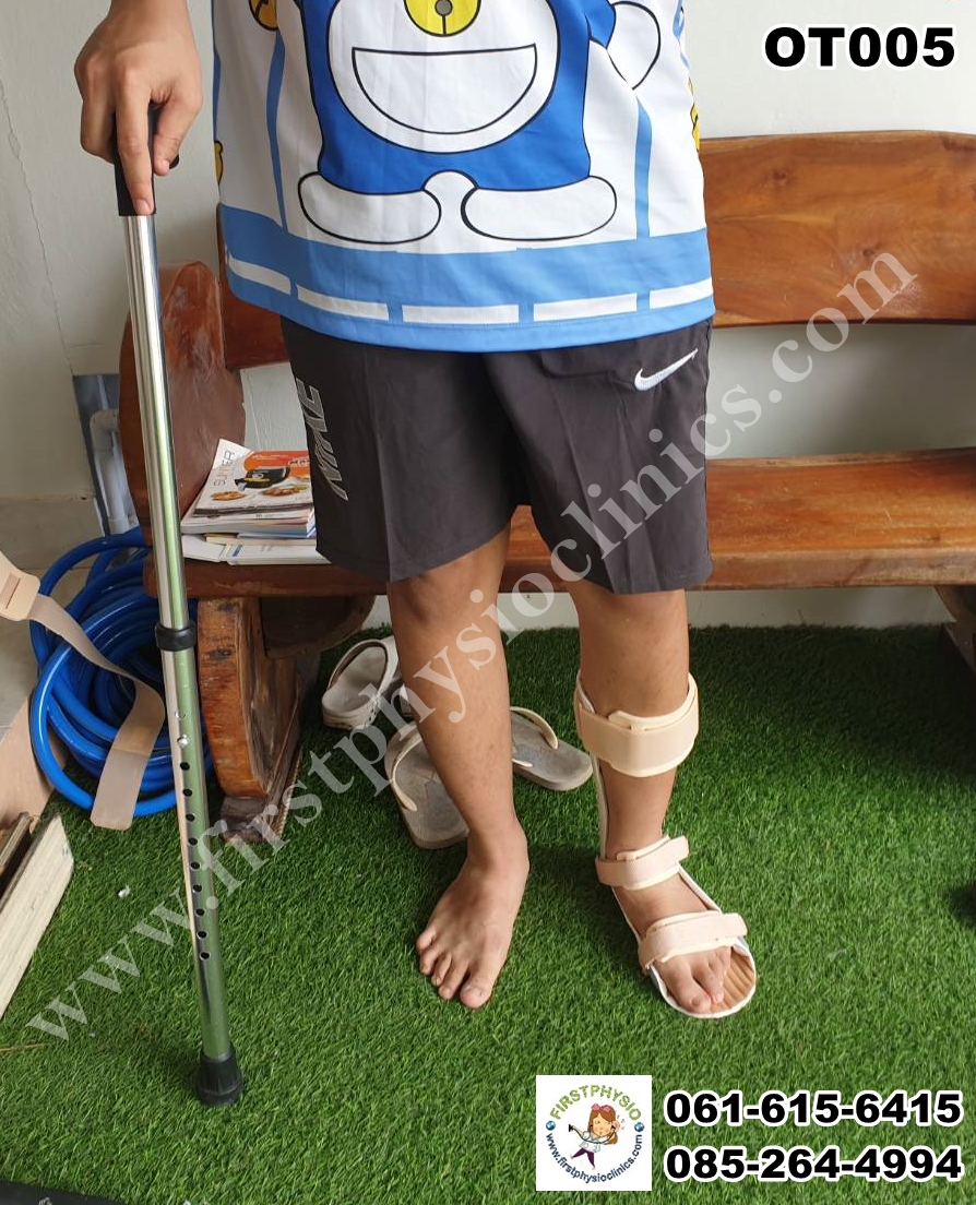 ช่วยเดินไม้เท้าขาเดียว ไม้เท้า 1 ปุ่ม (Cane)