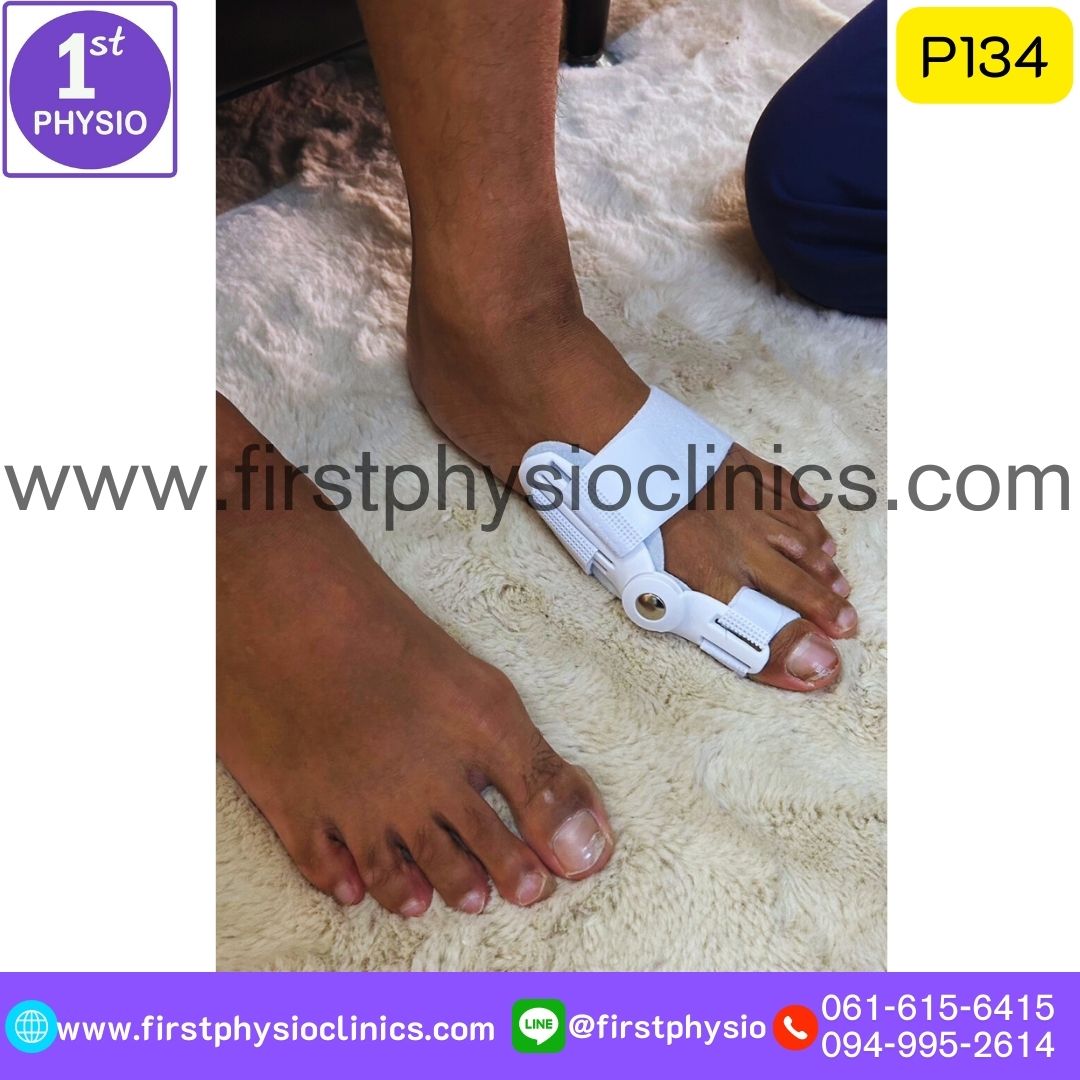 ที่ดามกันนิ้วหัวแม่เท้าเอียง/ที่ดามกันนิ้วโป้งเท้าเอียง/อุปกรณ์ดามนิ้วเท้าเก/อุปกรณ์แก้เท้าผิดรูป