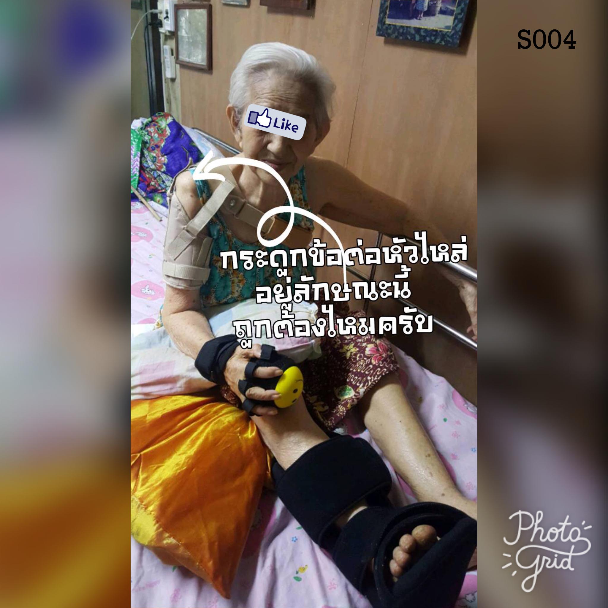 พยุงข้อไหล่หลวม พยุงไหล่ ที่พยุงไหล่ สายรัดพยุงไหล่ปรับได้ ประคองหัวไหล่ สายรัดไหล่ สายรัดพยุงไหล่ shoulder support Bobath Sling