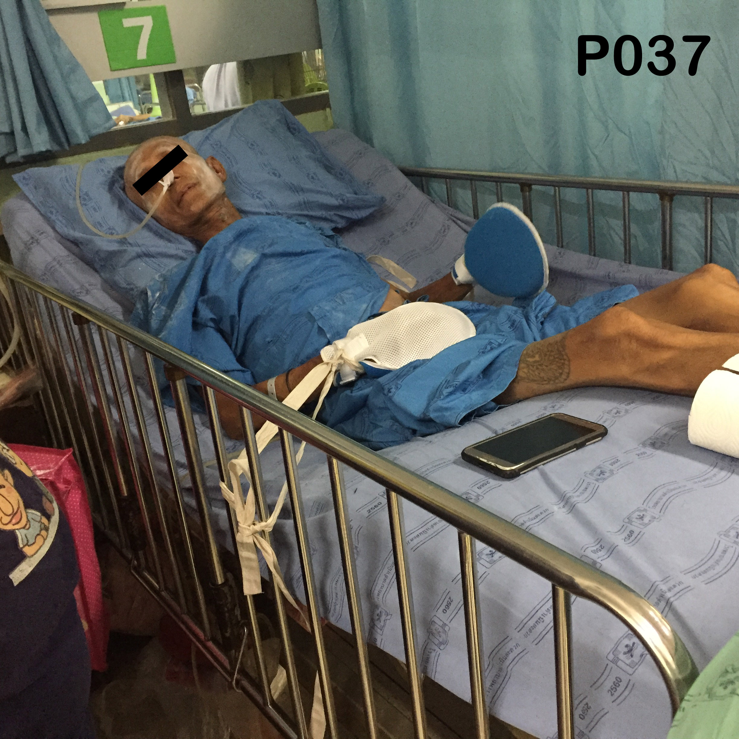 ถุงมือกันดึงกันดิ้น (Protection Glove)