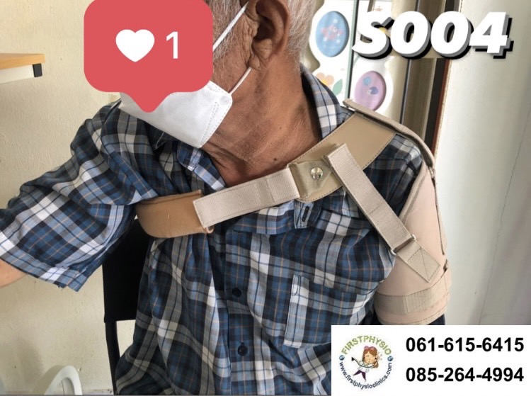 พยุงข้อไหล่หลวม พยุงไหล่ ที่พยุงไหล่ สายรัดพยุงไหล่ปรับได้ ประคองหัวไหล่ สายรัดไหล่ สายรัดพยุงไหล่ shoulder support Bobath Sling