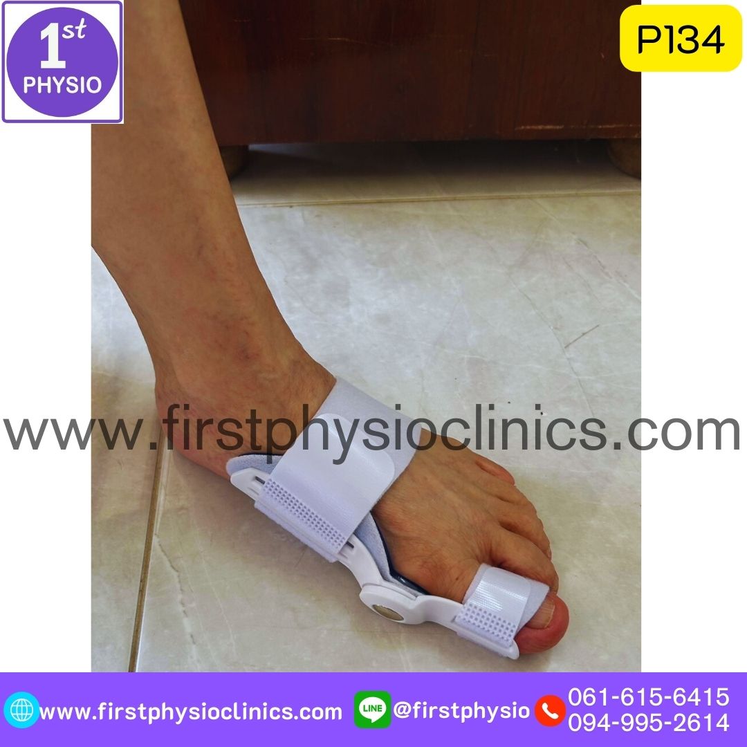 ที่ดามกันนิ้วหัวแม่เท้าเอียง/ที่ดามกันนิ้วโป้งเท้าเอียง/อุปกรณ์ดามนิ้วเท้าเก/อุปกรณ์แก้เท้าผิดรูป