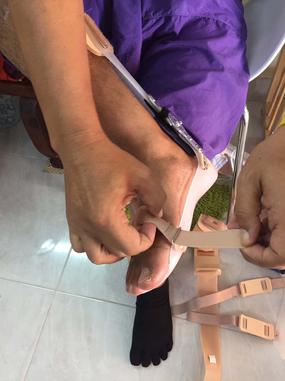 ดามกันปลายเท้าตกแบบปรับองศา (AFO Gait Assist) กันปลายเท้าตก เท้าแกว่ง ดามข้อเท้า ดามปลายเท้า ที่ประคองปลายเท้า