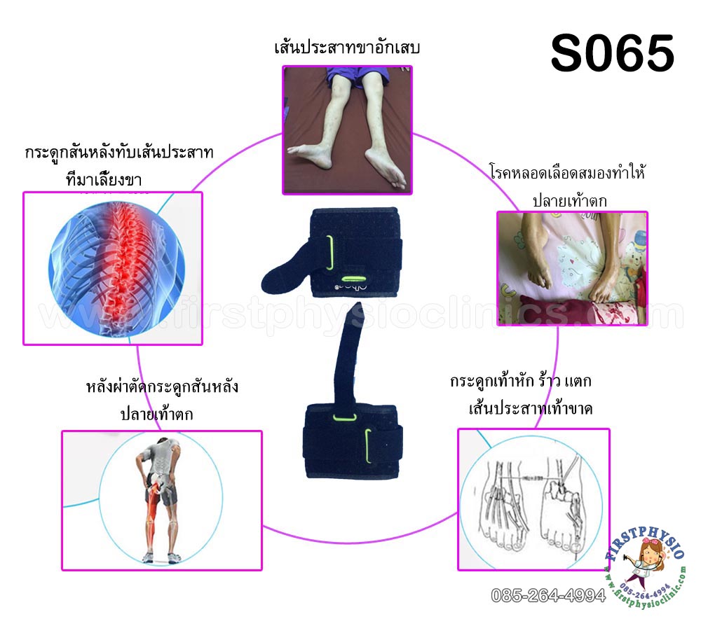 สายรัดกระดกเท้า (Foot up)/อุปกรณ์กันปลายเท้าตก/เท้าแกว่ง/สายรัดพยุงข้อเท้า/สายรัดพยุงปลายเท้า/ที่ประคองปลายเท้า