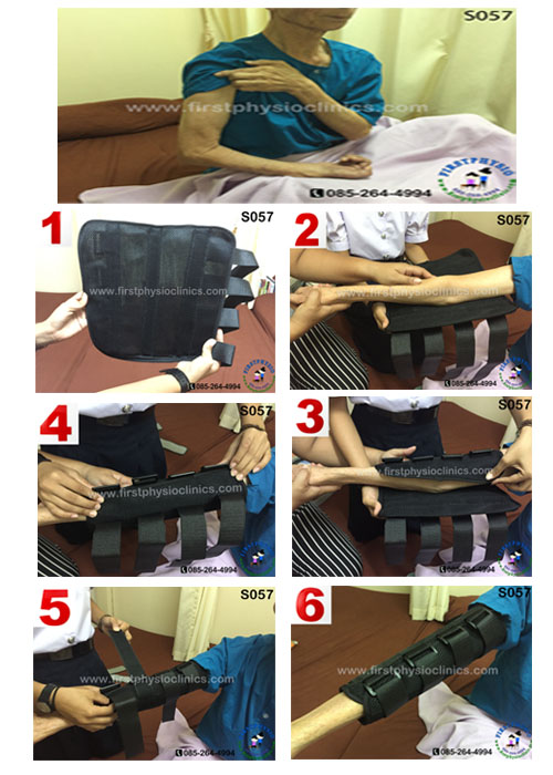 FIRSTPHYSIO/อุปกรณ์เหยียดข้อศอกผู้ใหญ่/ดามข้อศอก/ข้อศอกติด//Elbow Stretch/อุปกรณ์ช่วยเหยียดศอกตรง/ที่ดัดข้อศอกตรง/อุปกรณ์ดามศอกลดเกร็ง