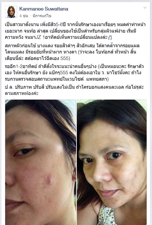 รีวิวจากผู้ใช้จริง Jz