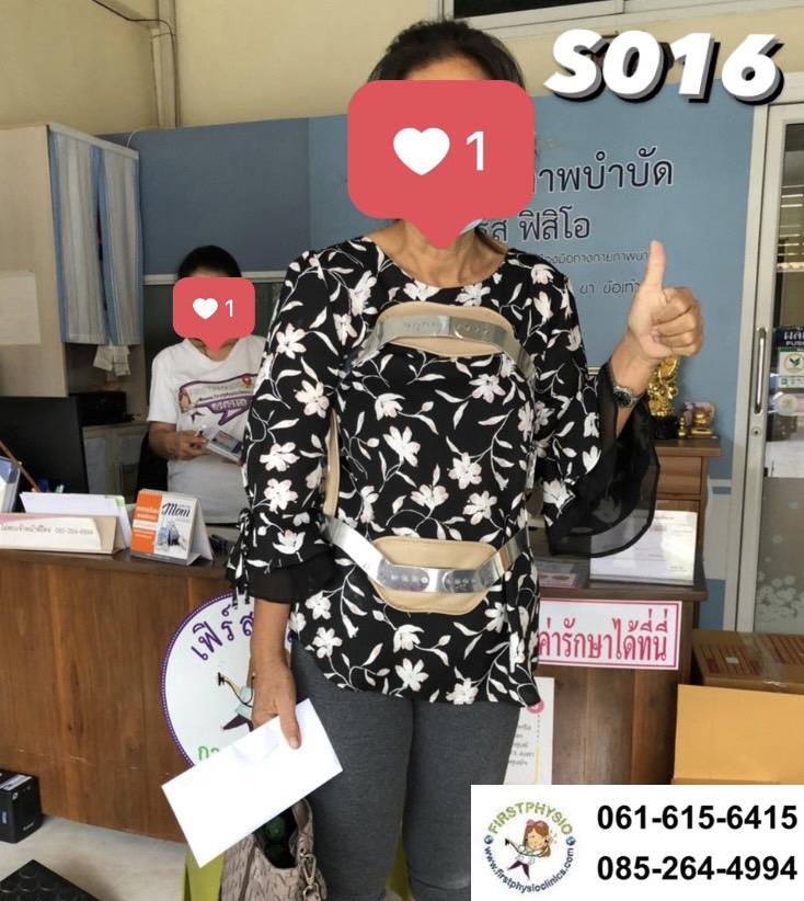 พยุงหลังโครงเหล็กด้านหน้า เจเวท พยุงลำตัวกระดูกทรุด ป้องกันการโค้งงอของหลังมาด้านหน้า,ด้านหลัง,ด้านข้าง Jewett Brace