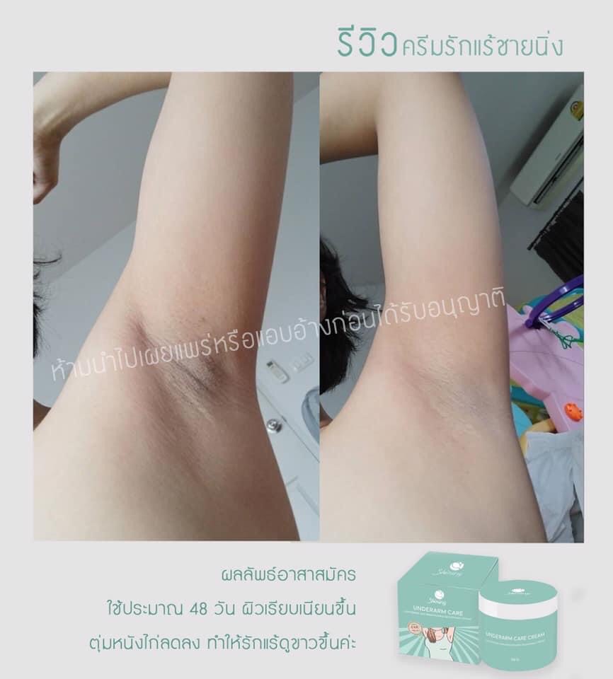 SHINING UNDERARM CARE CREAM ครีมทารักแร้ ก้น ขาหนีบ ข้อศอก หัวเข่า ลดตุ่มหนังไก่ ระงับกลิ่นกาย