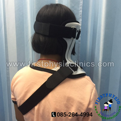 FIRSTPHYSIO/กันคอเอียงในเด็ก