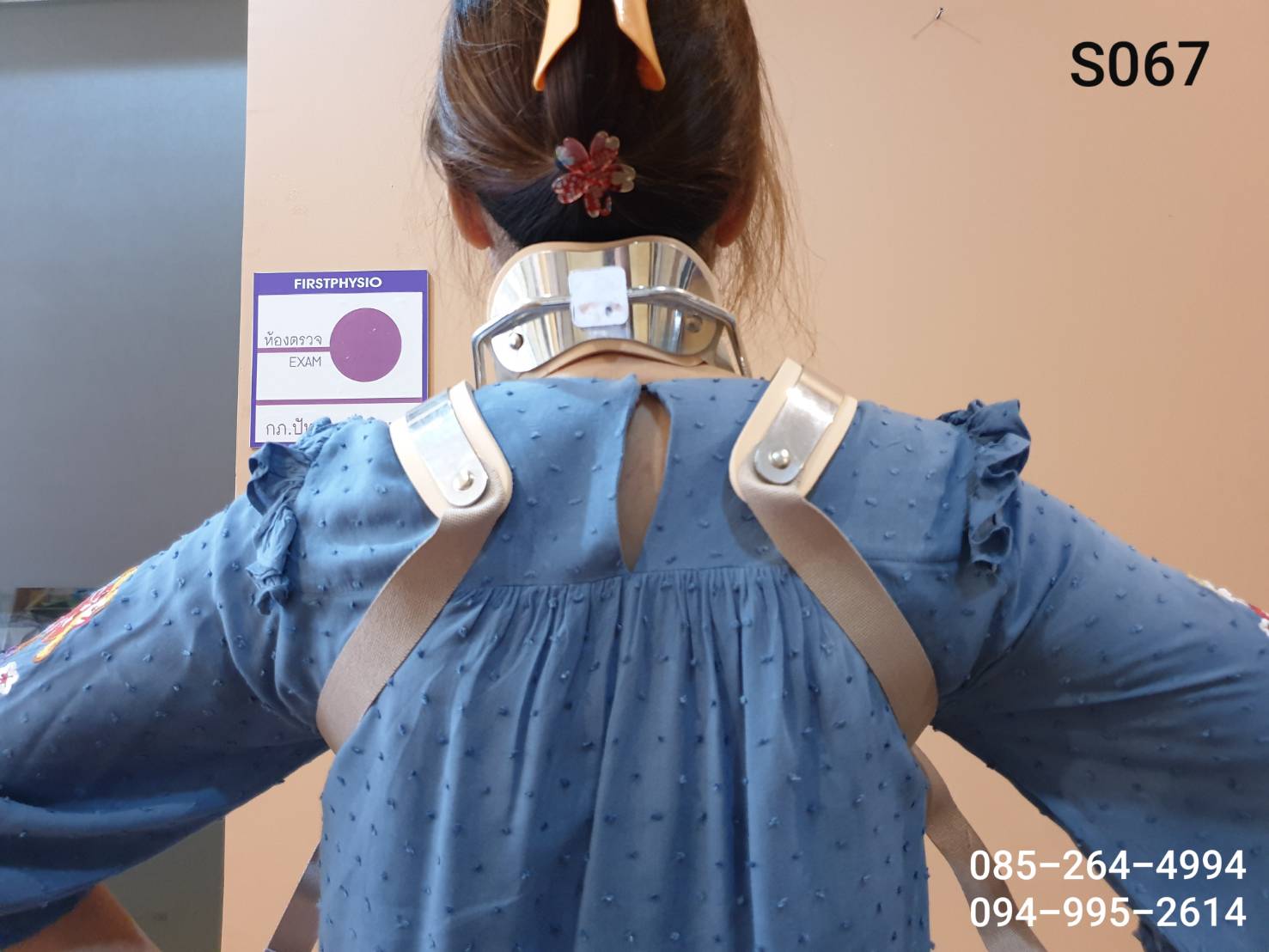 SOMI Brace โซมิเบรด คอเคลื่อน พยุงคอ Sterno-Occipital-Mandibular-lmmobilizer