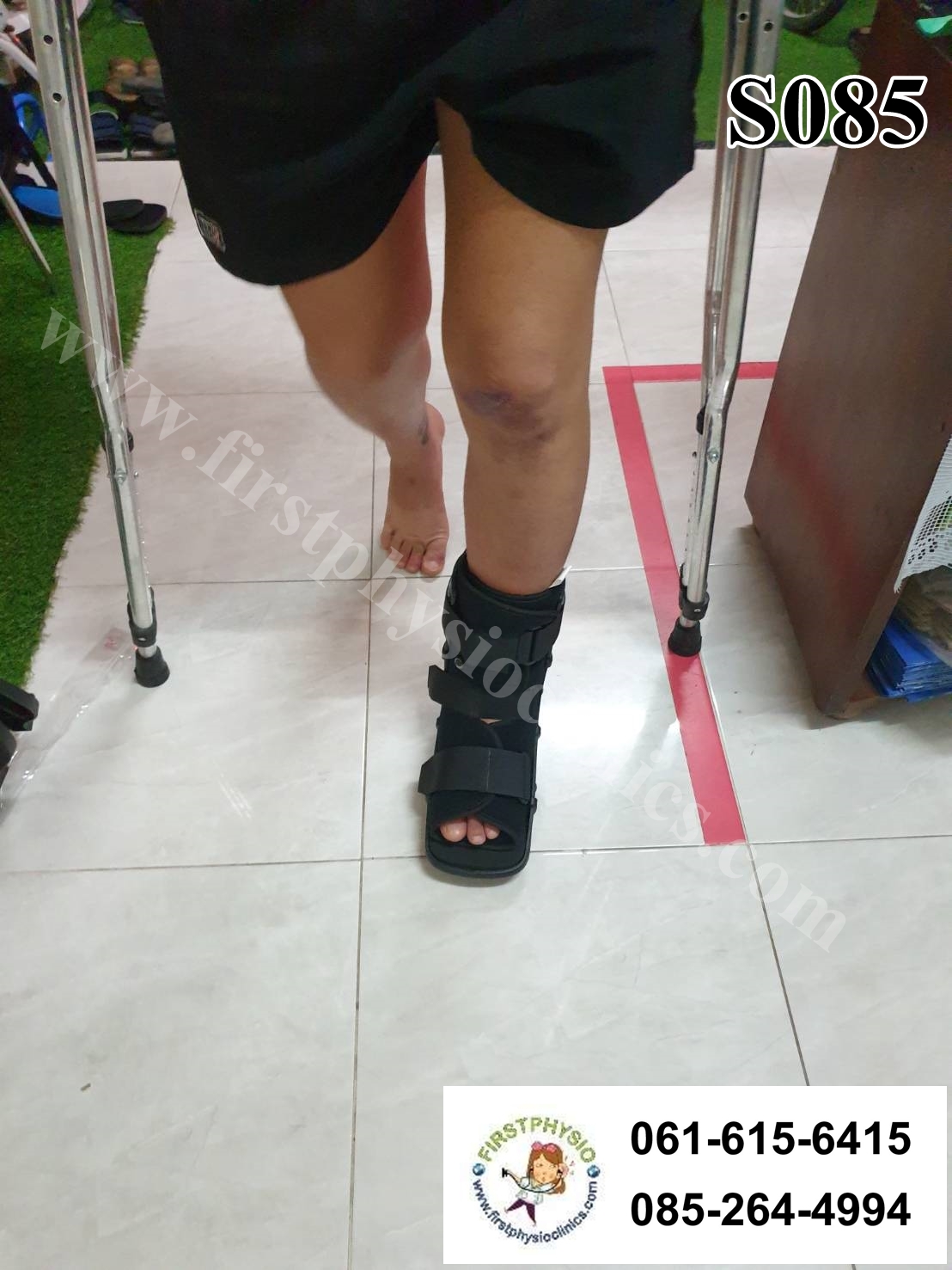 รองเท้าเฝือกลม แบบสั้น / เฝือกลม /รองเท้าหลังถอดเฝือก / รองเท้าเฝือก (air cast)/อุปกรณ์ช่วยพยุงเท้าและข้อเท้า เฝือกเท้าและข้อเท้า ป้องกันการกระแทกลดอาการบาดเจ็บ ป้องกันกระดูกเคลื่อนผิดที่