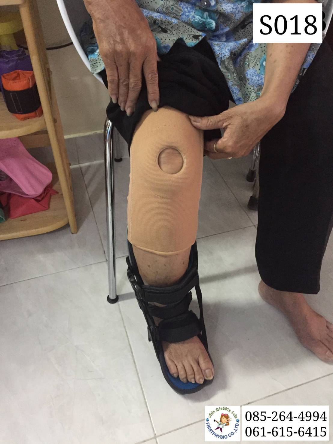 พยุงข้อเข่าและสะบ้าแบบมีแกน พยุงเข่า ที่พยุงเข่า อุปกรณ์พยุงเข่า พยุงหัวเข่ามีแกน2ข้าง Knee Support แบบมีแกน พยุงเข่าแบบมีแกน [Open Patella Flexible Bars]