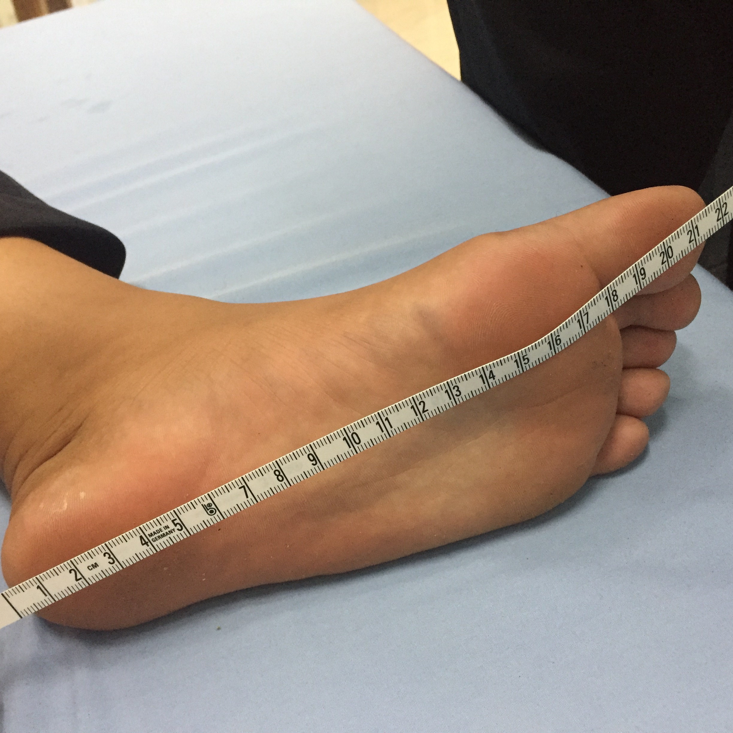 พลาสติกดามข้อเท้าแบบเปิดส้น (ANKLE FOOT ORTHOSIS (AFO)LEAF SPRING)