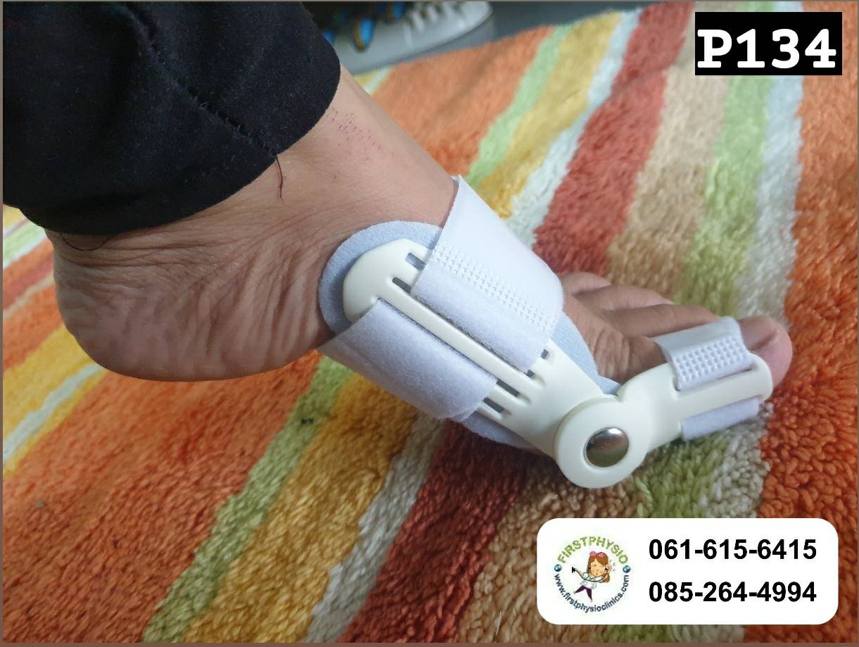 ที่ดามกันนิ้วหัวแม่เท้าเอียง/ที่ดามกันนิ้วโป้งเท้าเอียง/อุปกรณ์ดามนิ้วเท้าเก/อุปกรณ์แก้เท้าผิดรูป