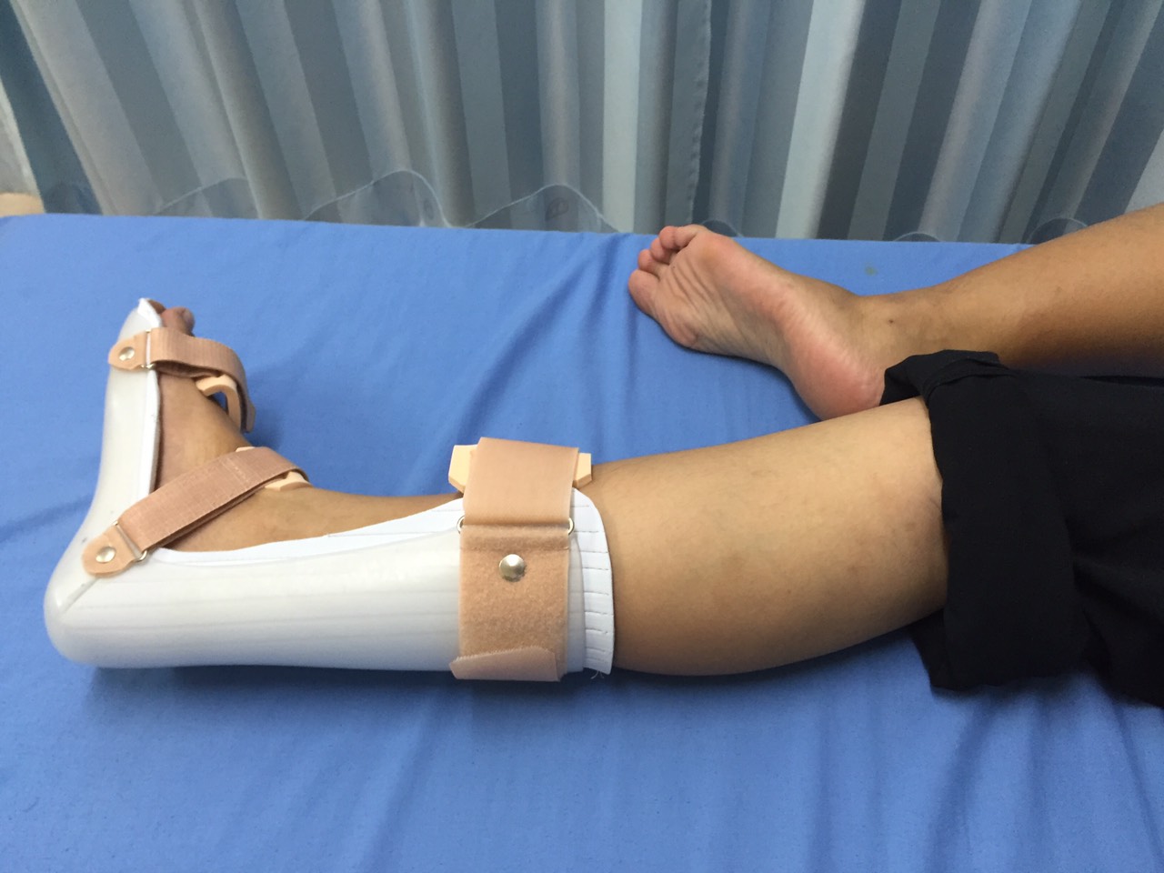 ดามกันปลายเท้าตกแบบบุนุ่ม (AFO Underpad) กันปลายเท้าตก เท้าแกว่ง ดามข้อเท้า ดามปลายเท้า ที่ประคองปลายเท้า