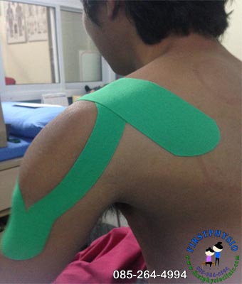 FIRSTPHYSIO/K-Tape for Shoulder Pain