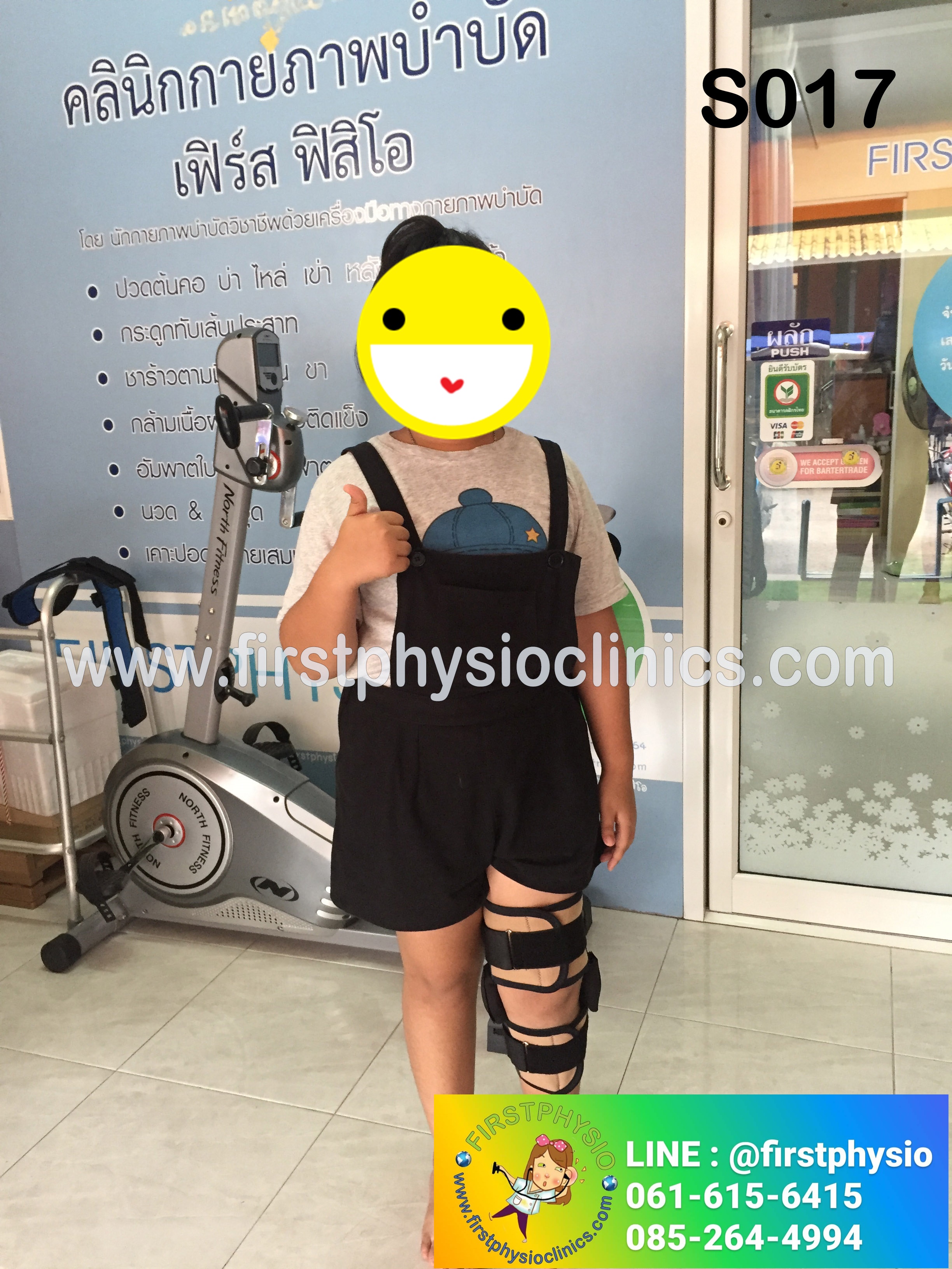 อุปกรณ์พยุงเข่าปรับองศาได้แบบสั้น/ประคองเข่าปรับมุม/พยุงเข่าแกนอลูมิเนียม Hinge Knee Support