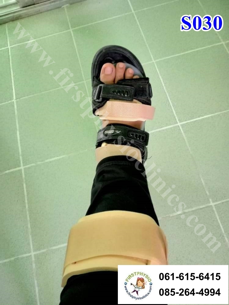 ดามกันปลายเท้าตกแบบปรับองศา (AFO Gait Assist) กันปลายเท้าตก เท้าแกว่ง ดามข้อเท้า ดามปลายเท้า ที่ประคองปลายเท้า