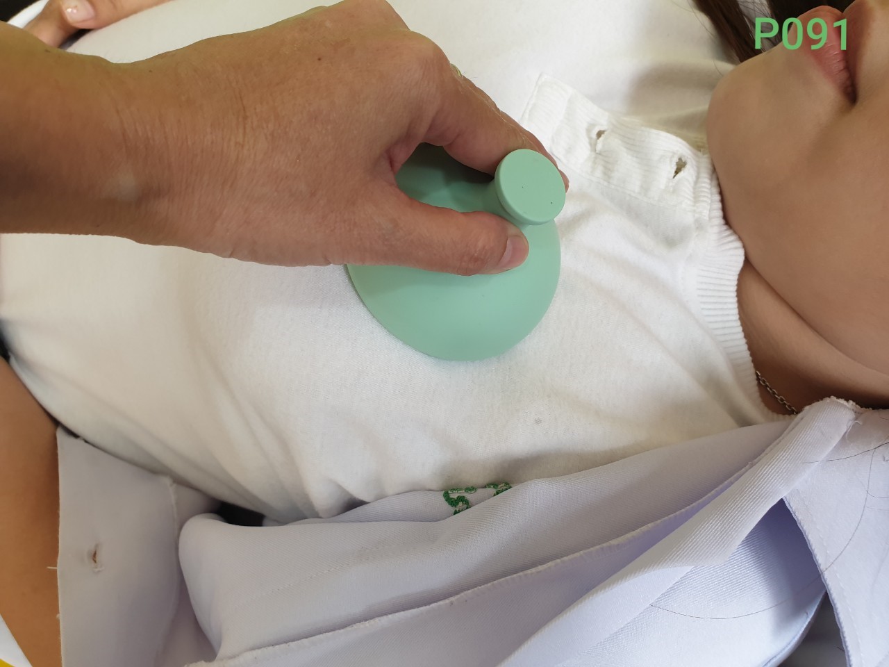 ถ้วยเคาะปอด/อุปกรณ์เคาะปอดระบายเสมหะ