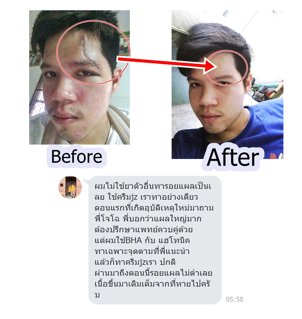 Jz' เจซี คลีนเซอร์ pH5.5 สะอาดอ่อนโยน ล้างหน้า อาบน้ำ สระผมในขวดเดียว : ไร้สี น้ำหอม ซิลิโคน แอลกอฮอล์ SLS พาราเบน ฯ