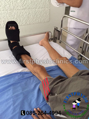 อุปกรณ์ดามกันเท้าตกแบบ 90 องศา อุปกรณ์ดามกันเท้าตก [#1 AFO 90]