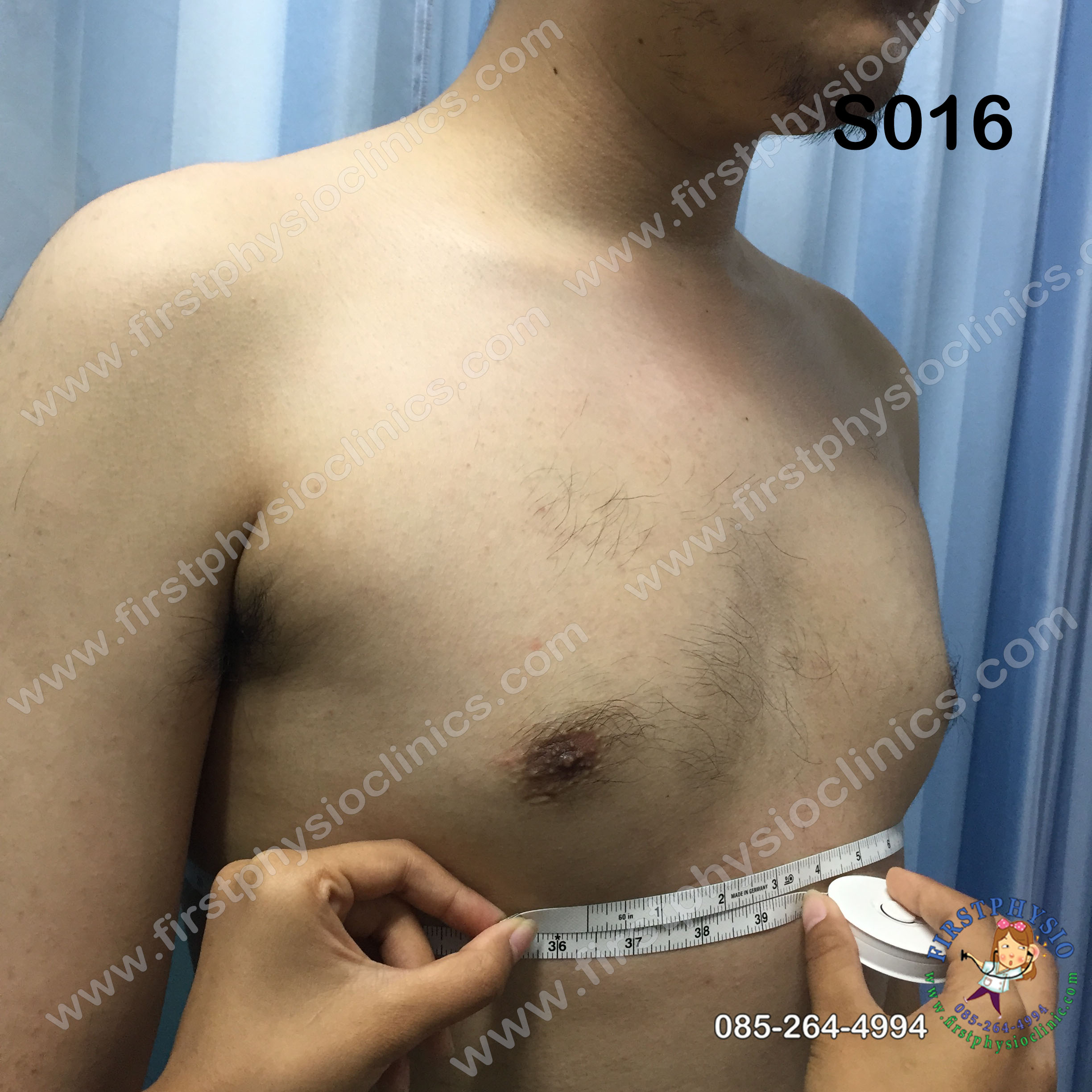 พยุงหลังโครงเหล็กด้านหน้า เจเวท พยุงลำตัวกระดูกทรุด ป้องกันการโค้งงอของหลังมาด้านหน้า,ด้านหลัง,ด้านข้าง Jewett Brace