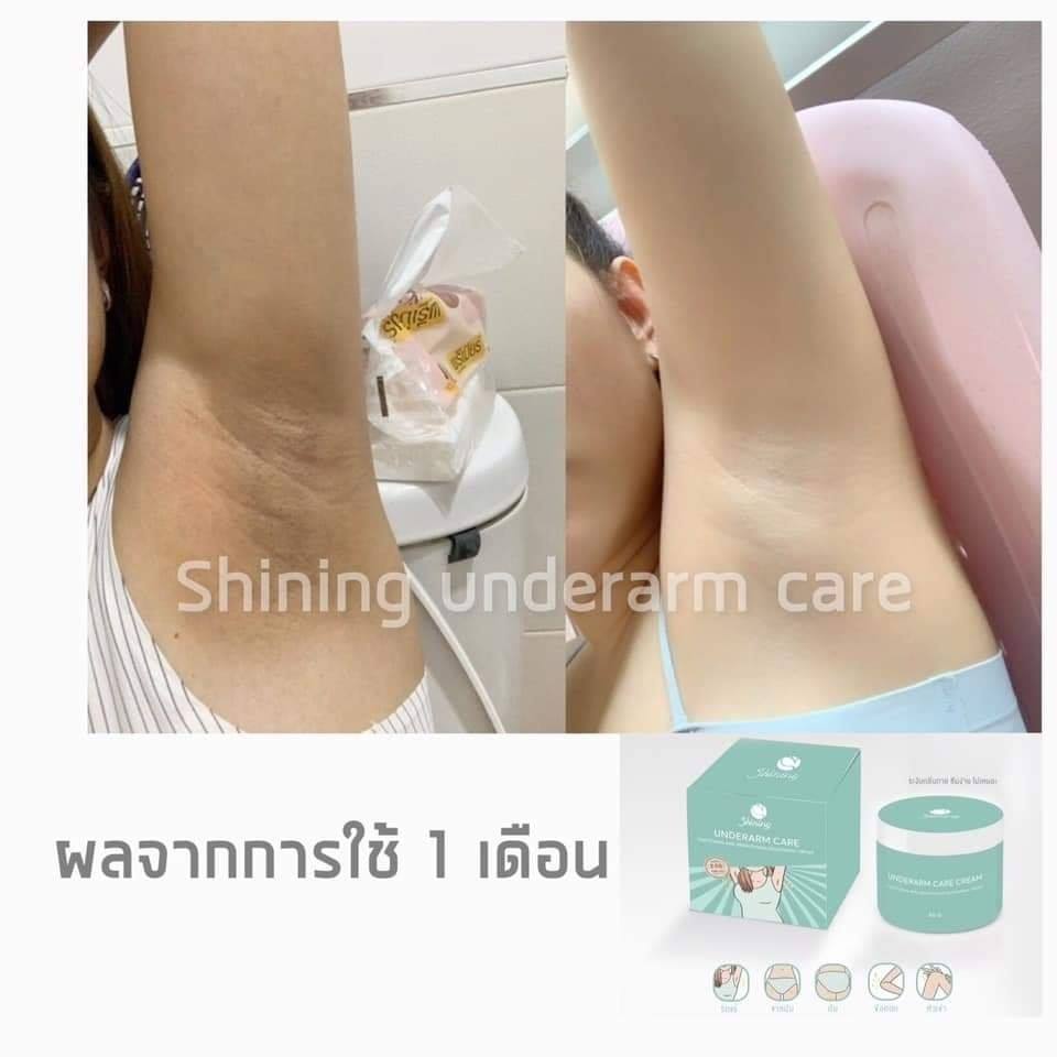 ครีมทารักแร้ขาว ชายนิ่ง 2 กระปุก 650 บาท แถมฟรีเทสโทนเนอร์