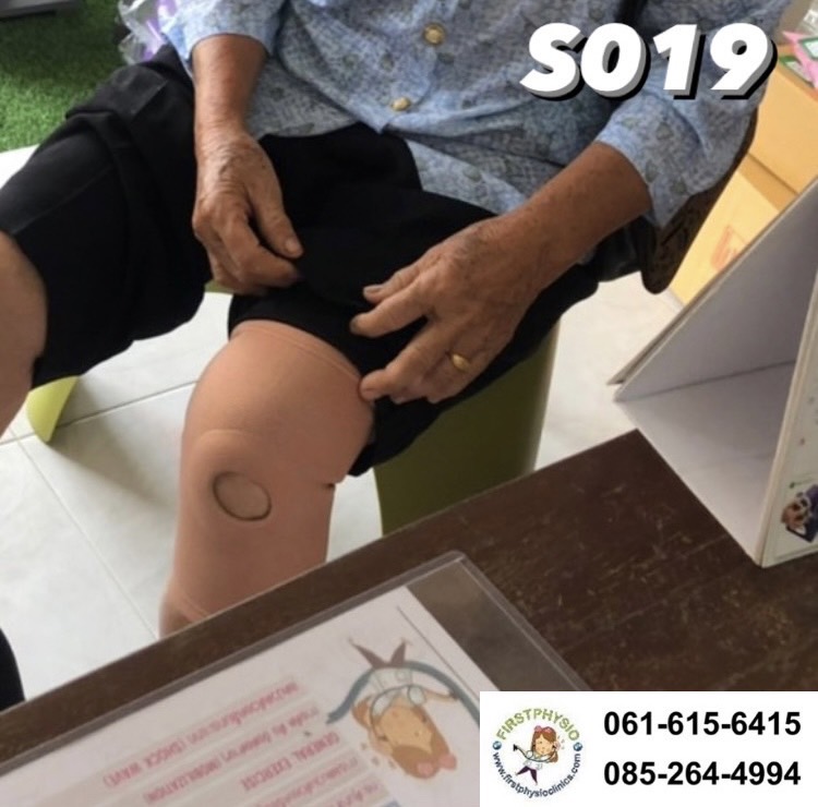 ผ้ายืดลดเข่า พยุงข้อเข่า ที่พยุงข้อเข่า พยุงเข่า สายรัดเข่า อุปกรณ์พยุงเข่า อุปกรณ์พยุงเข่า (Knee Support)ไม่มีแกนด้านข้าง [Knee Support]