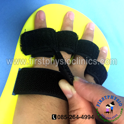 อุปกรณ์ดามกันนิ้วมืองอ /อุปกรณ์กายภาพนิ้ว/อุปกรณ์เหยียดนิ้วมือ/พลาสติกดามข้อมือ/palmar correction splint