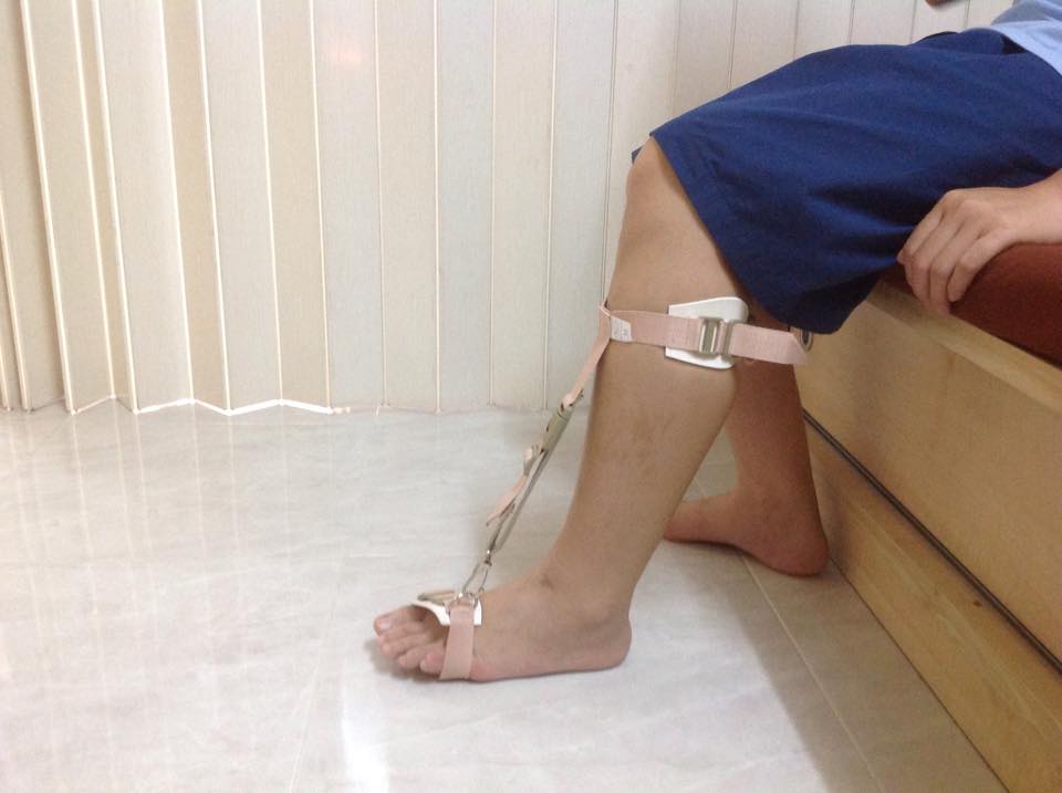 พยุงเท้าตก [Foot Sling] สายรัดกระดกเท้า (Foot up) กันปลายเท้าตก เท้าแกว่ง สายรัดพยุงข้อเท้า สายรัดพยุงปลายเท้า ที่ประคองปลายเท้า