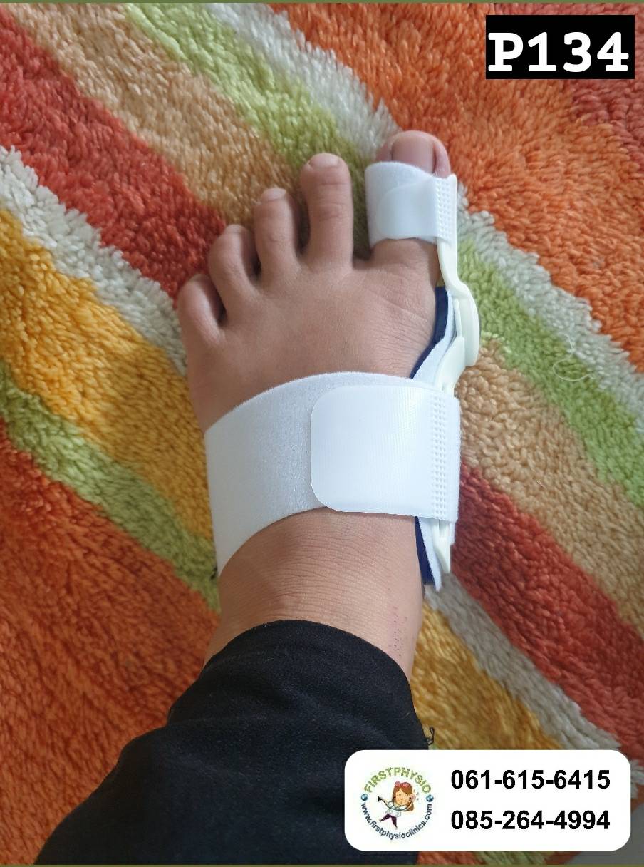 ที่ดามกันนิ้วหัวแม่เท้าเอียง/ที่ดามกันนิ้วโป้งเท้าเอียง/อุปกรณ์ดามนิ้วเท้าเก/อุปกรณ์แก้เท้าผิดรูป