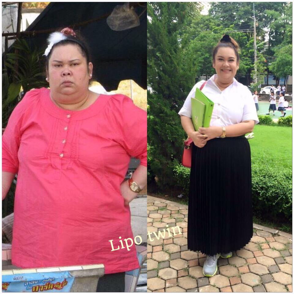 http://www.thankbeauty.com/category/64/lipo-twin-%E0%B9%84%E0%B8%A5%E0%B9%82%E0%B8%9B%E0%B8%97%E0%B8%A7%E0%B8%B4%E0%B8%99