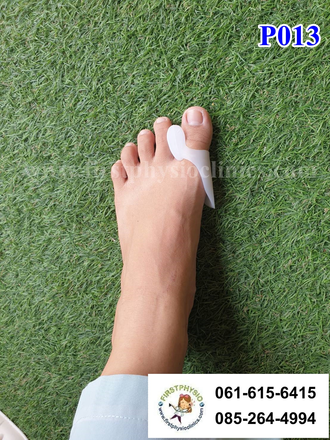 ซิลิโคนแยกนิ้วเท้าเก Correct Toe/นิ้วเท้าผิดรูป /หัวนิ้วแม่เท้าผิดรูป/นิ้วโป้งเท้าเก ผิดรูป