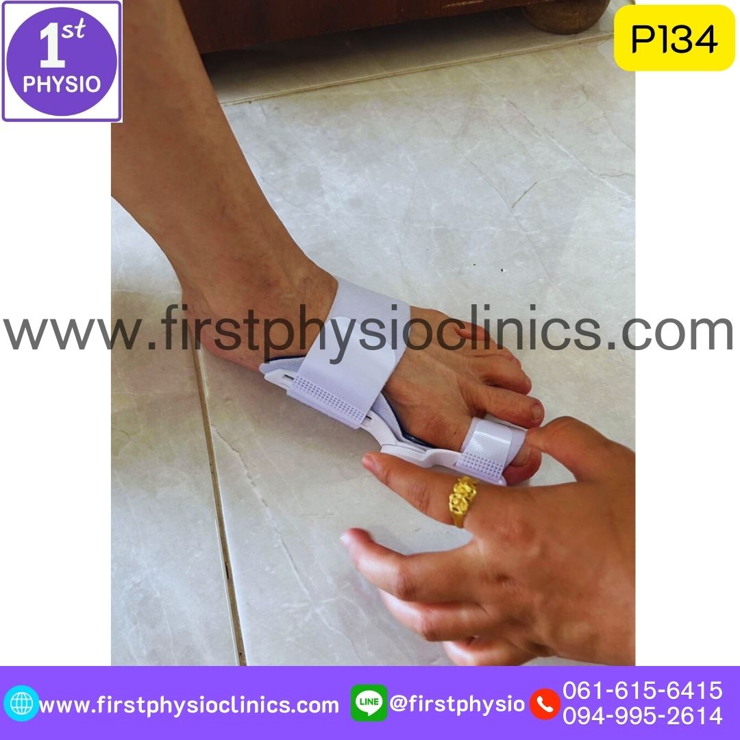 ที่ดามกันนิ้วหัวแม่เท้าเอียง/ที่ดามกันนิ้วโป้งเท้าเอียง/อุปกรณ์ดามนิ้วเท้าเก/อุปกรณ์แก้เท้าผิดรูป