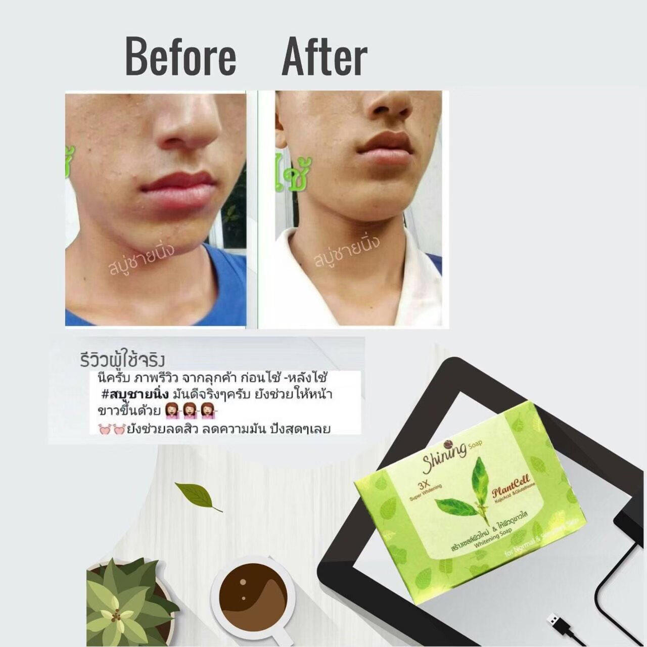 สบู่ชายนิ่ง สบู่จากสเต็มเซลล์พืช ธรรมชาติล้วนๆ ลดสิวได้ทั้งผิวหน้าและผิวกาย