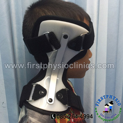 FIRSTPHYSIO/กันคอเอียงในเด็ก