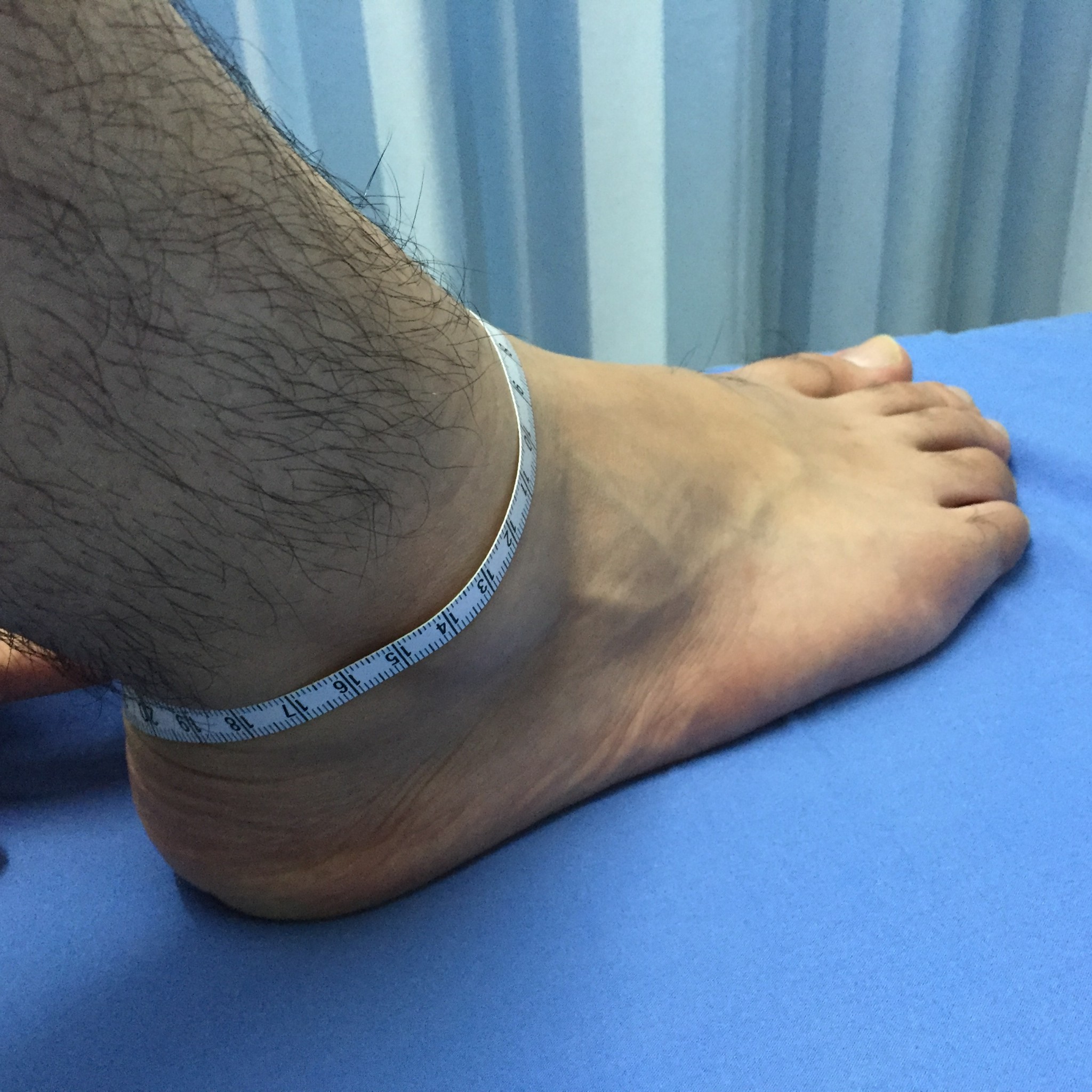 ผ้ายืดรัดข้อเท้า ที่รัดข้อเท้า ซัพพอร์ตเท้า ผ้ารัดข้อเท้า ที่พยุงข้อเท้า อุปกรณ์พยุงข้อเท้า ที่รัดซัพพอร์ตข้อเท้า ผ้ารัดข้อเท้า [Ankle Support]