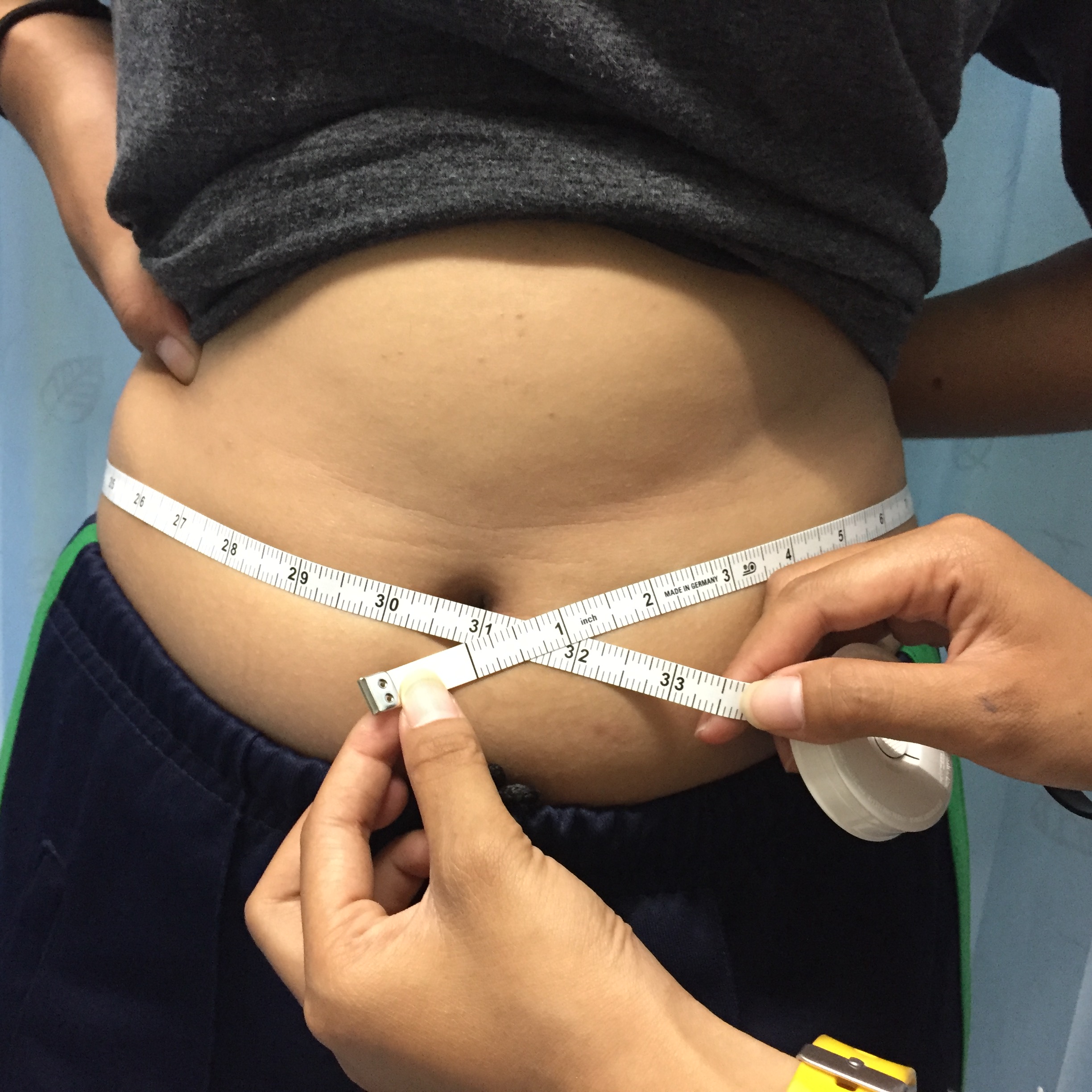 เข็มขัดช่วยเดิน (Safety Belt)