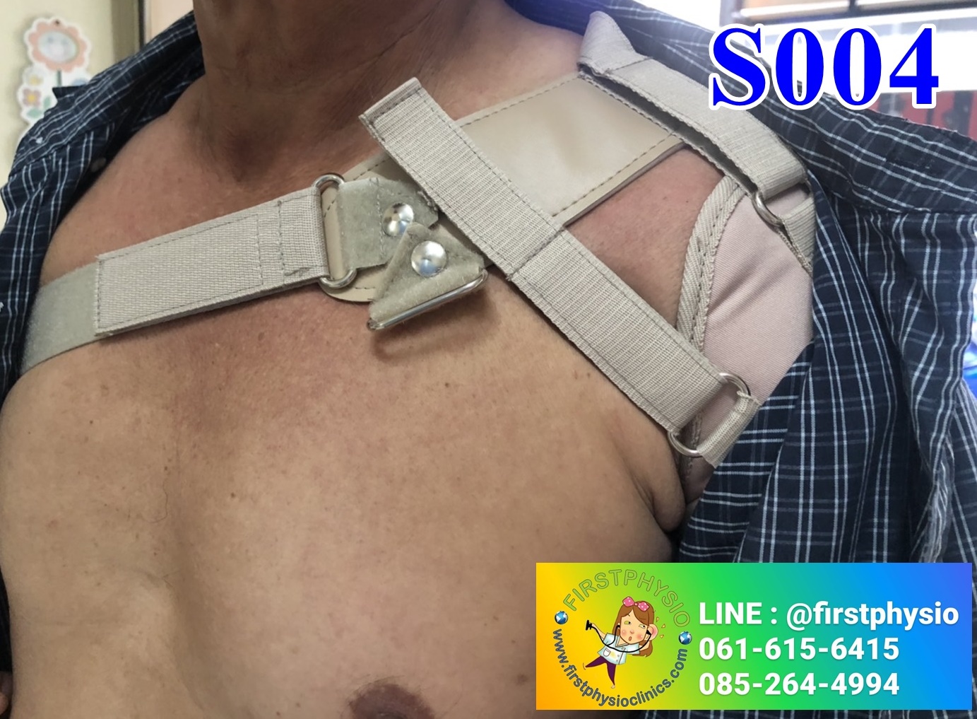 พยุงข้อไหล่หลวม พยุงไหล่ ที่พยุงไหล่ สายรัดพยุงไหล่ปรับได้ ประคองหัวไหล่ สายรัดไหล่ สายรัดพยุงไหล่ shoulder support Bobath Sling